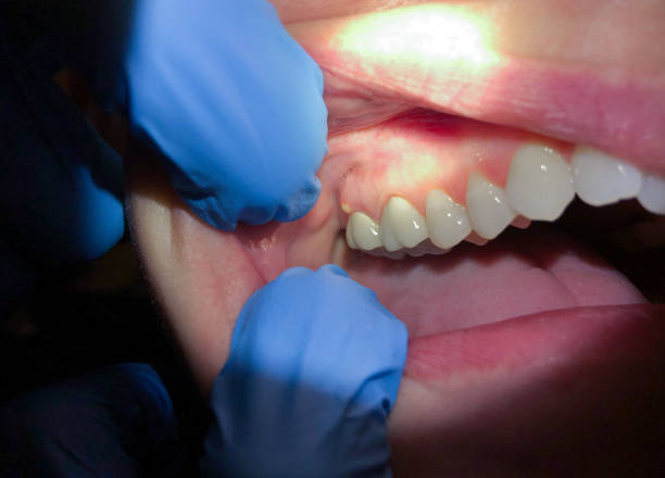 Best Emergency Tooth Extraction  in Middletown, CA