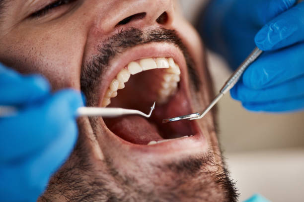 Best Broken Tooth Emergency  in Middletown, CA